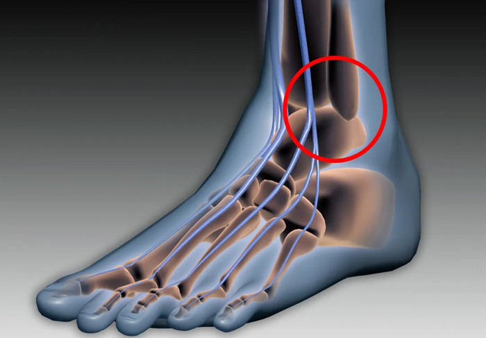 【醫(yī)療科普】：下脛腓關節(jié)復位