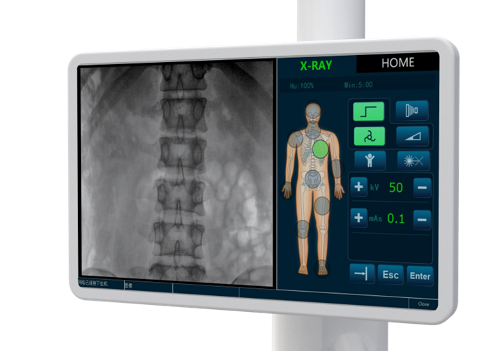 PLX119C一體化大平板C臂——多功能觸控操作屏 PLX119C一體化大平板C臂——多功能觸控操作屏