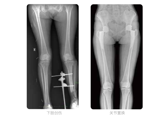 動態數字化X線攝影(動態DR)成像 動態數字化X線攝影(動態DR)成像