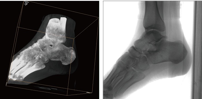 移動三維C形臂平板拍攝圖像 移動三維C形臂平板拍攝圖像