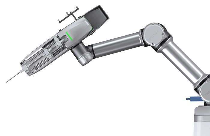 骨科手術機器人多少錢一臺